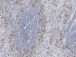Sino Biological Azurocidin / CAP37 / AZU1 Antibody, Rabbit PAb, Antigen