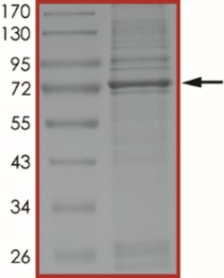 Sino Biological&nbsp;Recombinant Human BTK Protein (Full Length, R562P, His Tag)
