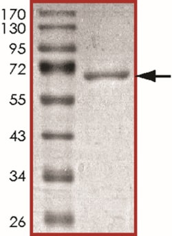 Sino Biological&nbsp;Recombinant Human BCKDK Protein (GST Tag)