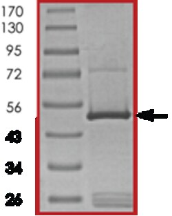Sino Biological&nbsp;Recombinant Human BID Protein (Full Length, GST Tag)