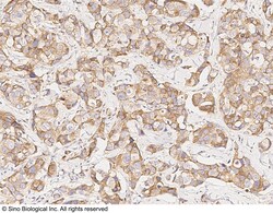 Sino Biological Anti-Brevican/Bcan Antibody, Rabbit Polyclonal, Quantity: