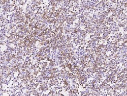 Sino Biological Anti-Bcl-2 Antibody, Mouse Monoclonal, Quantity: Each of