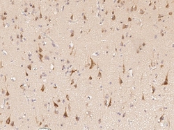 Sino Biological Anti-Biglycan Antibody, Rabbit Polyclonal, Quantity: Each