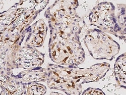 Sino Biological p22 BID Antibody, Rabbit PAb, Antigen Affinity Purified