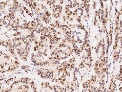 Sino Biological Anti-Survivin/BIRC5 Antibody, Rabbit Polyclonal, Quantity: