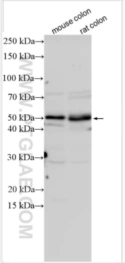 BMPR1B Rabbit, anti-Human, Polyclonal, Proteintech Quantity: 20 &mu;L:Antibodies