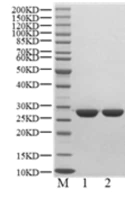 BIORTUS USA INC&nbsp;Human SPR Protein, 100UG