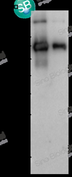 Sino Biological SARS-CoV-2 (2019-nCoV) Spike S2 Antibody, Rabbit PAb, Antigen