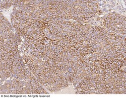 Sino Biological Anti-BTG3 Antibody, Rabbit Polyclonal, Quantity: Each of