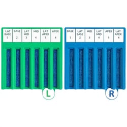 Mopec&nbsp;Lumea Lab Demo Kit