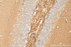 Bassoon Rabbit, anti-Human, Polyclonal, Proteintech Quantity: 150 &mu;L:Antibodies