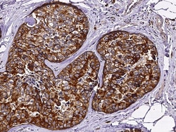 Sino Biological c-Kit / CD117 Antibody, Rabbit MAb 100µL, Quantity: Each