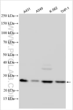 C19orf40 Rabbit, anti-Human, Polyclonal, Proteintech Quantity: 150 &mu;L:Antibodies