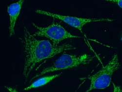 Sino Biological C1QBP / HABP1 Antibody, Mouse MAb 100µL, Quantity: Each