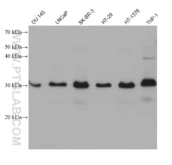 C22orf25 Mouse, anti-Human, Clone: 2G5B8, Proteintech Quantity: 150 &mu;L:Antibodies