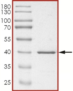 Sino Biological&nbsp;Recombinant Human CDKN2A/p16INK4a Protein (Full Length, GST Tag)