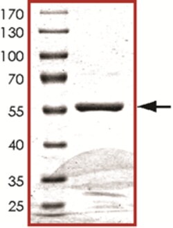 Sino Biological&nbsp;Recombinant Human CDK4 Protein (Full Length, GST Tag)