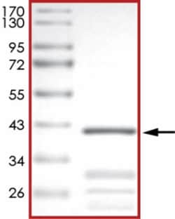 Sino Biological&nbsp;Recombinant Human CDKN2B/p15INK4b Protein (Full Length, GST Tag)