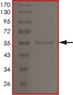 Sino Biological&nbsp;Recombinant Human CDK5 Protein (Full Length, GST Tag)
