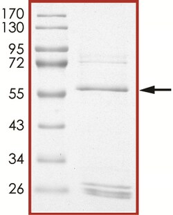 Sino Biological&nbsp;Recombinant Human Cyclin D3/CCND3 Protein (Full Length, GST Tag)