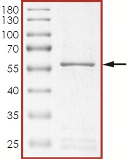 Sino Biological&nbsp;Recombinant Human cyclin D1 Protein (Full Length, GST Tag)