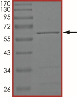 Sino Biological&nbsp;Recombinant Human Cyclin Y/CCNY Protein (GST Tag)