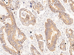Sino Biological Carbonic Anhydrase XII / CA12 Antibody, Rabbit PAb, Antigen