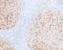 Sino Biological Carbonic Anhydrase XIV / CA14 Antibody, Rabbit MAb 100µL,