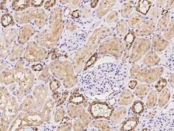 Sino Biological Carbonic anhydrase II Antibody, Rabbit PAb, Antigen Affinity