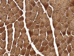 Sino Biological Carbonic Anhydrase III / CA3 Antibody, Rabbit MAb 100µL,