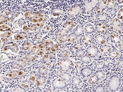 Sino Biological Recombinant Anti-VE-Cadherin Antibody, Rabbit Monoclonal,