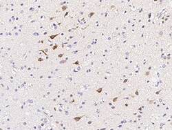 Sino Biological Anti-Calbindin Antibody, Rabbit Polyclonal, Quantity: Each