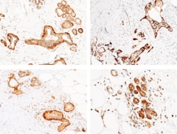 Sino Biological CALML3 Antibody, Rabbit PAb, Antigen Affinity Purified