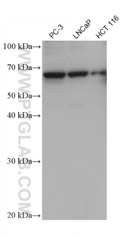 CAMK2G Mouse, anti-Human, Clone: 1C12H10, Proteintech Quantity: 150 &mu;L:Antibodies