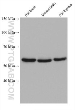 CAMK4 Mouse, anti-Human, Clone: 1G7A7, Proteintech:Antibodies:Primary Antibodies