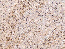 Sino Biological CAMKV Antibody, Rabbit PAb, Antigen Affinity Purified 100µL,