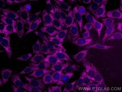 CAPN2 Mouse, anti-Human, CoraLite Plus 647, Clone: 1E1F10, Proteintech