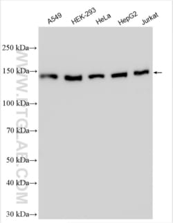 CCAR1 Rabbit, anti-Human, Polyclonal, Proteintech Quantity: 150 &mu;L:Antibodies