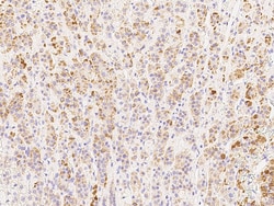 Sino Biological Anti-MCP-1/CCL2 Antibody, Rabbit Polyclonal, Quantity:
