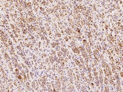 Sino Biological Anti-MCP-1/CCL2 Antibody, Rabbit Polyclonal, Quantity:
