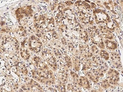 Sino Biological Anti-Cyclin B2 Antibody, Rabbit Polyclonal, Quantity: Each