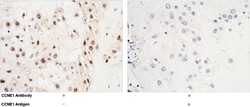 Sino Biological CCNE1 / Cyclin-E1 Antibody, Rabbit PAb, Antigen Affinity