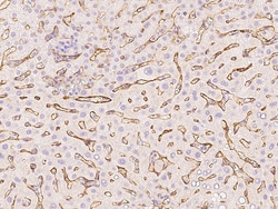 Sino Biological Anti-Endoglin/CD105 Antibody, Rabbit Polyclonal, Quantity: