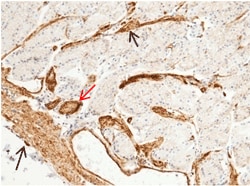 Sino Biological CD146 / MCAM Antibody, Rabbit MAb 100uL, Quantity: Each