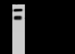Sino Biological CD19 Antibody, Mouse MAb 100uL, Quantity: Each of 1