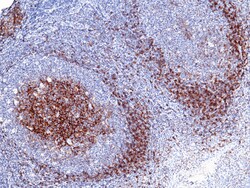 Sino Biological Anti-CD23 Antibody, Mouse Monoclonal, Quantity: Each of
