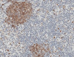 Sino Biological CD32b / FCGR2B Antibody, Rabbit MAb 100uL, Quantity: Each