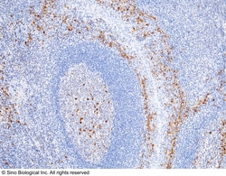 Sino Biological CD38 Antibody, Rabbit MAb 100uL, Quantity: Each of 1