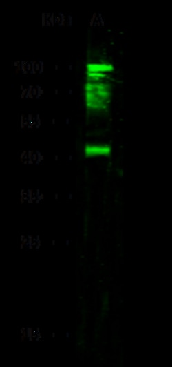 Sino Biological CD64 / FCGR1 Antibody, Rabbit PAb, Antigen Affinity Purified