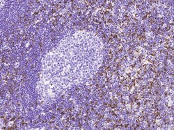 Sino Biological Anti-CD8 alpha Antibody, Rabbit Polyclonal, Quantity: Each